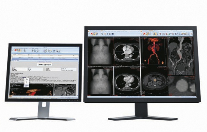 Foto: Philips | Vue Reporting