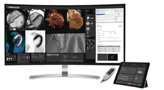 Foto: Siemens Healthineers | Syngo Carbon