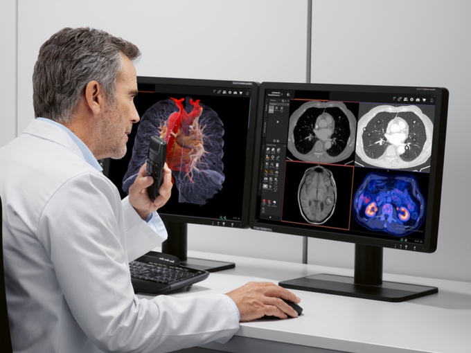 Foto: Siemens Healthineers | syngo.via