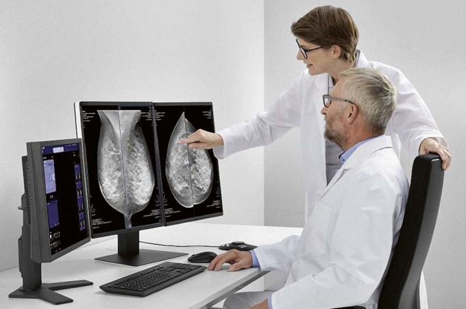Foto: Siemens Healthineers | syngo.Breast Care