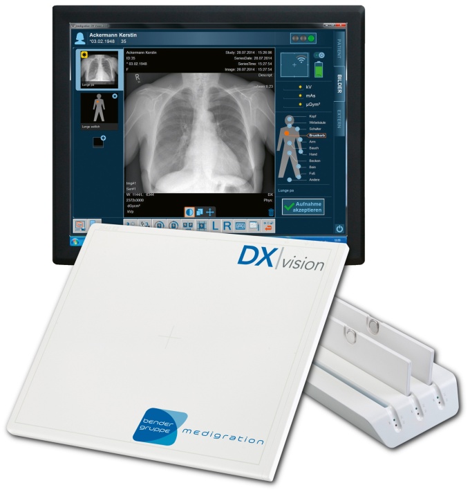 Foto: medigration | DR-Retrofi t-Kit DX | Vision...