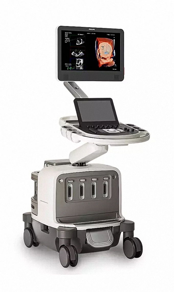 Foto: Philips | Affiniti CVx
