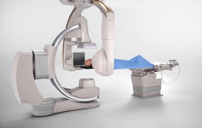 Foto: Canon Medical | Alphenix Biplane