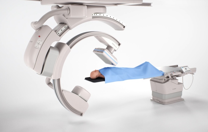 Foto: Canon Medical | Alphenix Sky+