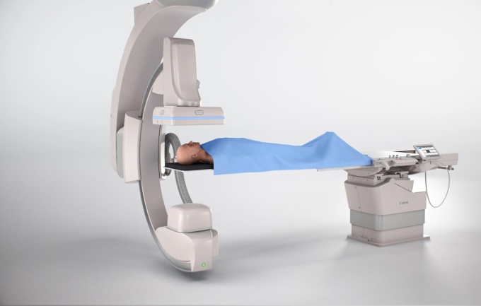 Foto: Canon Medical | Alphenix Sky
