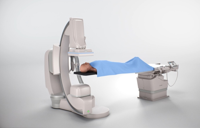 Foto: Canon Medical | Alphenix Core+