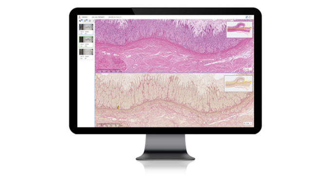 Foto: INFINITT | Digital Pathology Solution