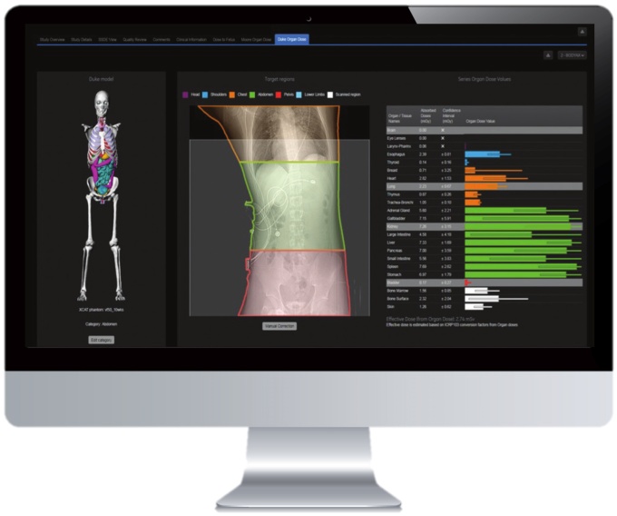 Foto: GE HealthCare | Dosewatch