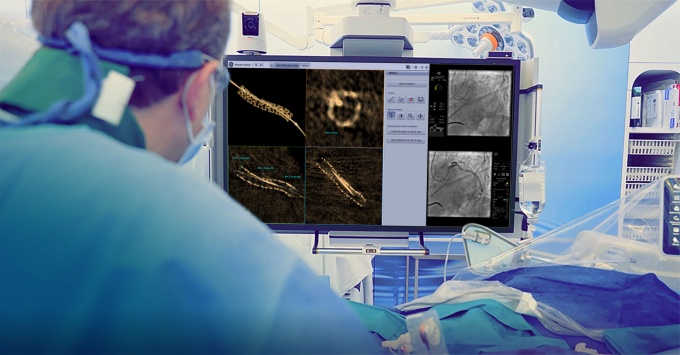 Foto: GE HealthCare | 3DStent