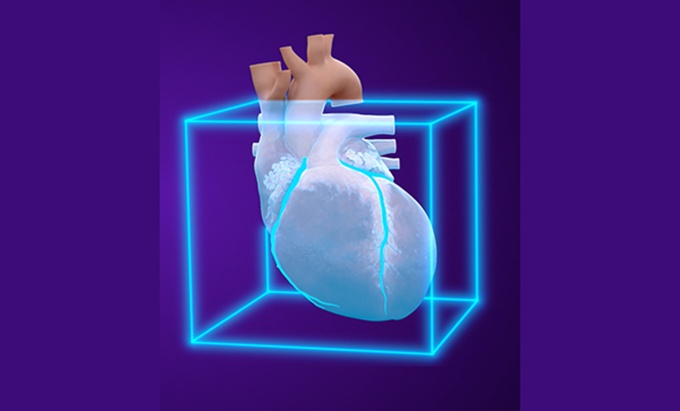 Foto: GE HealthCare | SnapShot Freeze 2