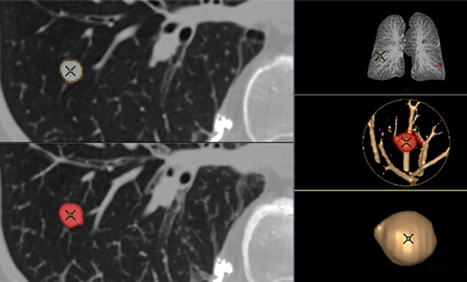 Foto: GE HealthCare | TrueFidelity