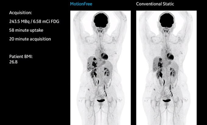 Foto: GE HealthCare | MotionFree