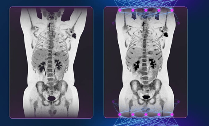 Foto: GE HealthCare | Precision DL