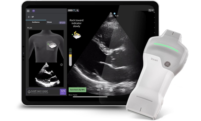 Foto: GE HealthCare | Caption AI
