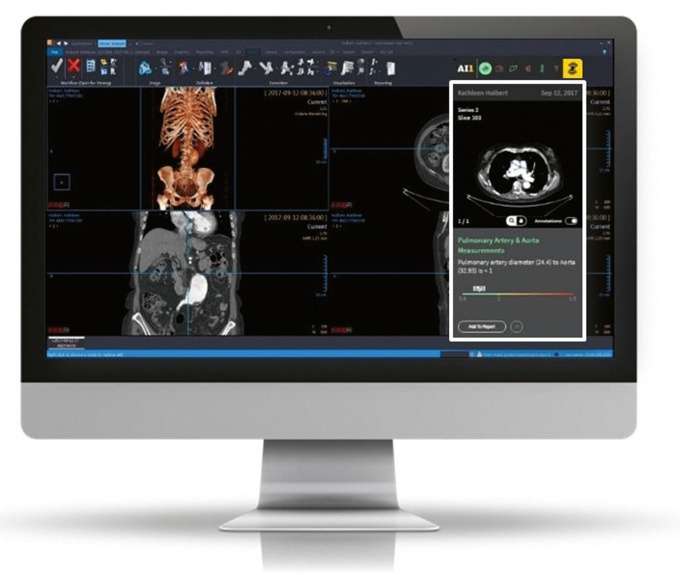 Foto: Philips | Imaging Analytics