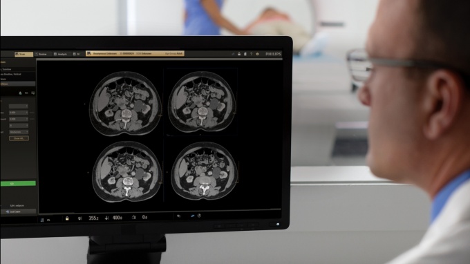 Foto: Philips | Precise Image